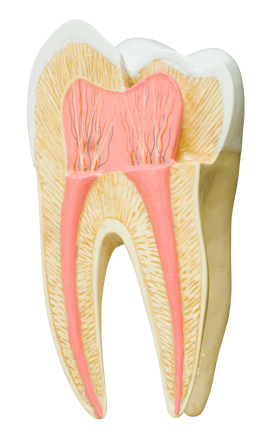 Diagram of tooth at oral surgeon office in San Juan, CA.